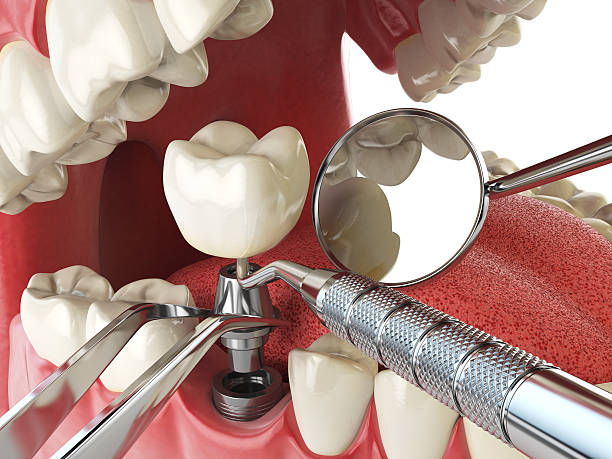 Best Orthodontic Emergency Dentist in Derma, MS
